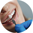 Dentist examining a dental implant shade on a patient's smile, highlighting major dental services covered by Amerus Financial insurance plans.