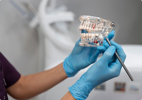 Dental professional demonstrating oral anatomy model with dental tools, highlighting preventive and major dental services relevant to comprehensive insurance coverage.